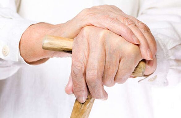 finger arthrosis in an elderly person